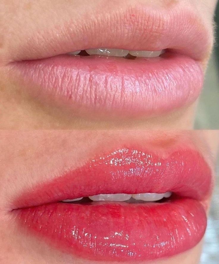 BB Lips Kurs